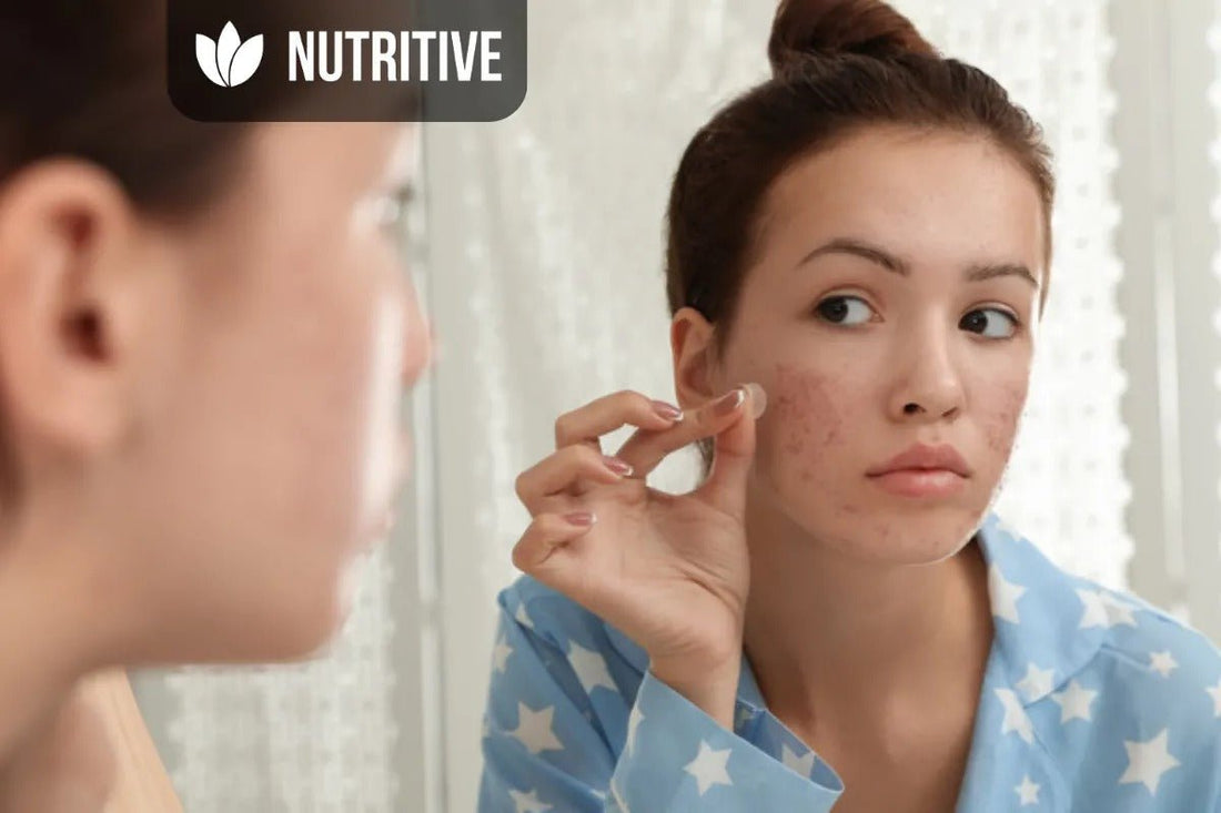 Патчі від прищів: таємниці їхньої ефективності та правила використання - Nutritive Cosmetics
