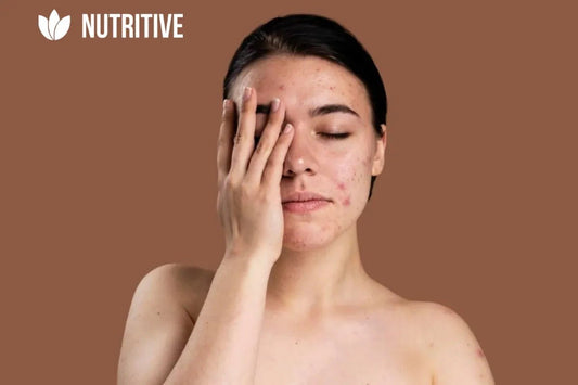 Як доглядати за проблемною шкірою обличчя - ТОП засобів від BIONO - Nutritive Cosmetics